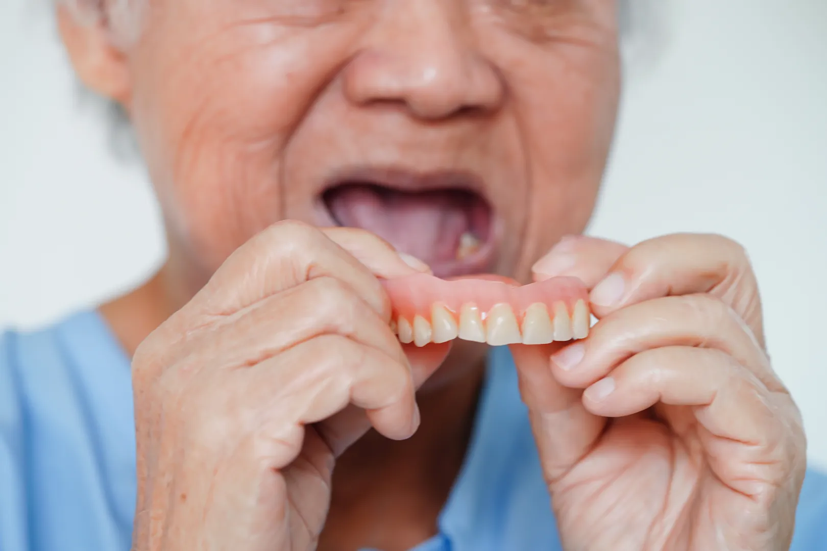 Invisalign Clear Aligners